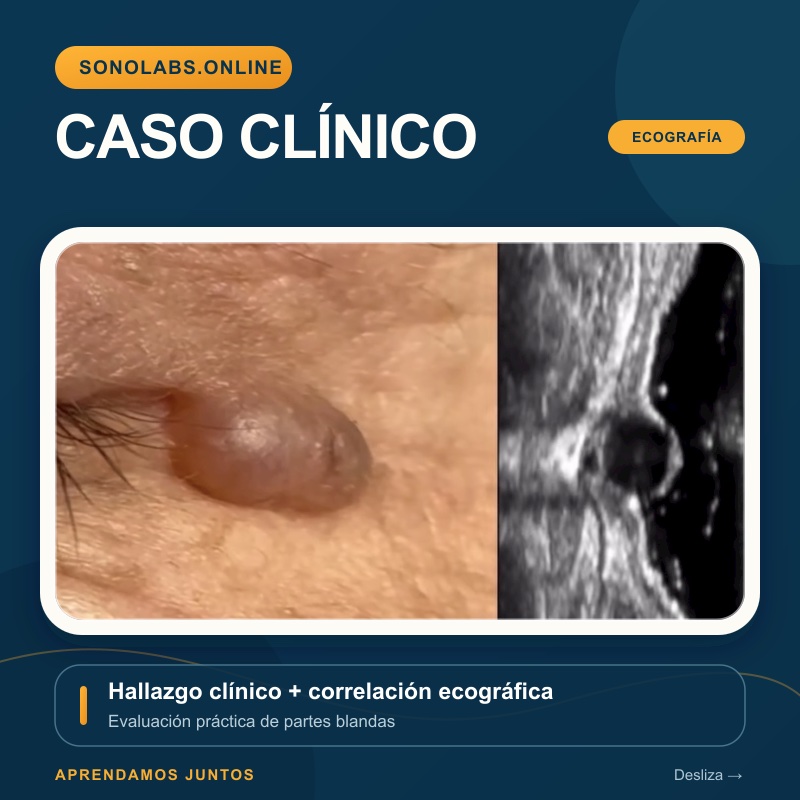 Caso clínico — correlación con ecografía
