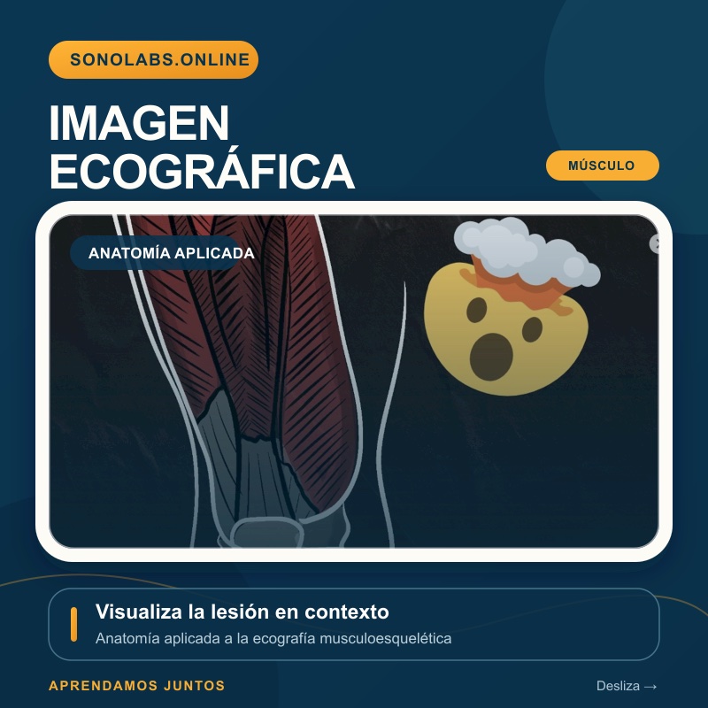 Imagen ecográfica — anatomía aplicada